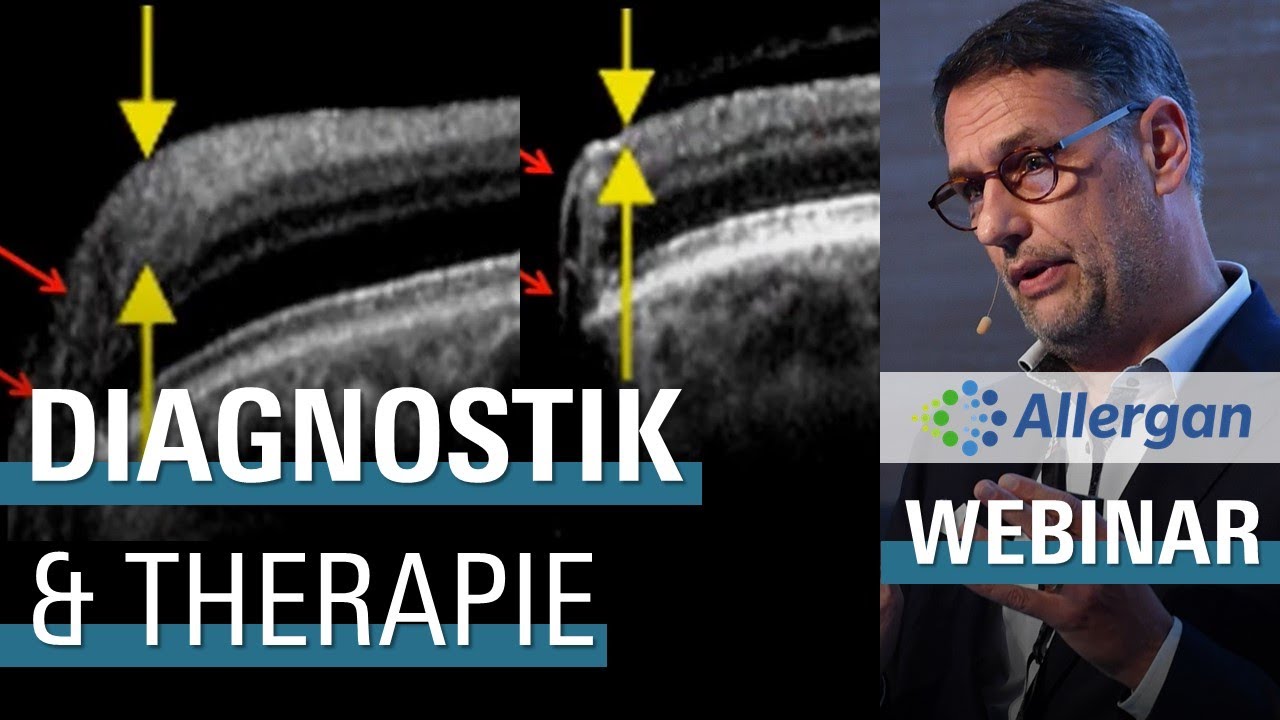 🇩🇪 Update Glaukom: Diagnostik und Therapie (Juli 2020)
