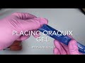 How to Place Oraqix Gel for Periodontal Therapy