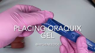 How to Place Oraqix Gel for Periodontal Therapy screenshot 1