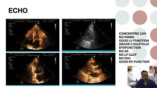 DECODING COMPLEX PCI CASE #14 By Dr. Sharath Reddy
