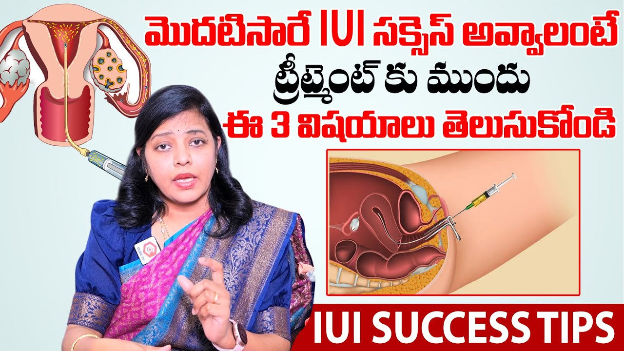 Best Three Main Steps For IUI Treatment Success | IUI Success Tips | Dr. Nayani, Fertility Expert