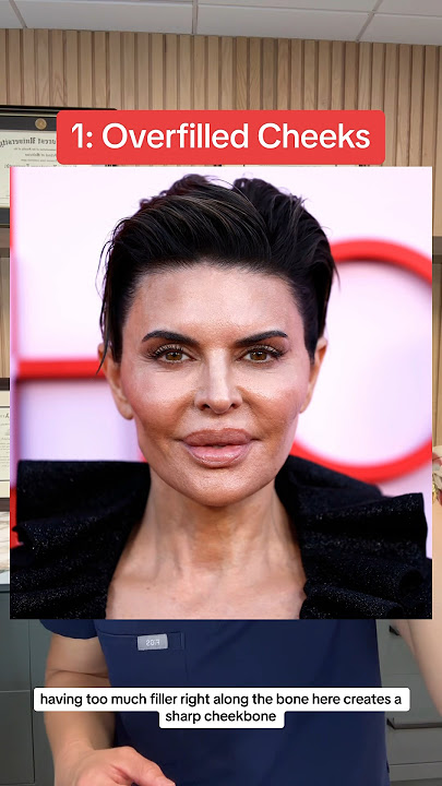 3 Signs To Stop Doing Fillers