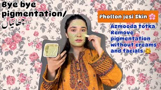 Melasma ka ilaj - Chehre ki Chaiyoon ka illaj - remove pigmentation!!