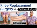 Knee Replacement surgery with Dr Himanshu Tyagi |  TKR/ TKA knee Arthroplasty. Knee arthritis