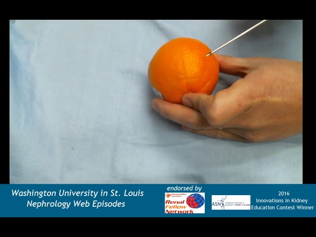 Web Episode 025b Kidney Biopsy Hands On Demonstration Youtube