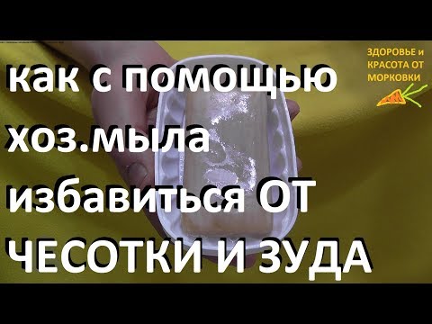 как с помощью хозяйственного мыла избавиться ОТ ЧЕСОТКИ И ЗУДА ?