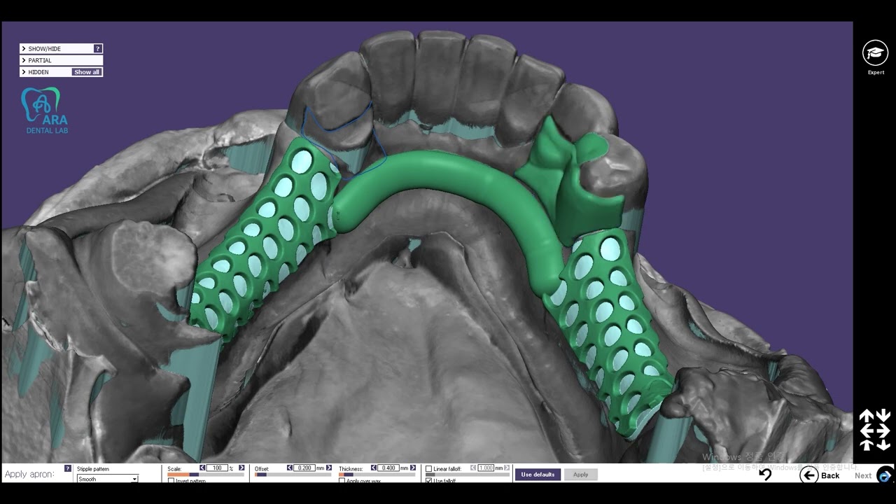 partial frame design lower  EXOCAD design