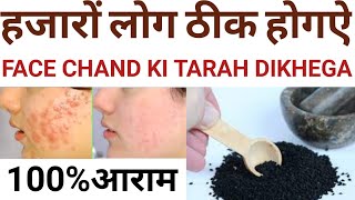 Pimples कील मुहासें दाद का हदीसी इलाज | chehre daane daag dhabbe kaise khatam karen | kalonji ka use