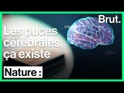 Vidéo: Les Implants Cérébraux Liquides Peuvent Augmenter Notre Intelligence - Vue Alternative