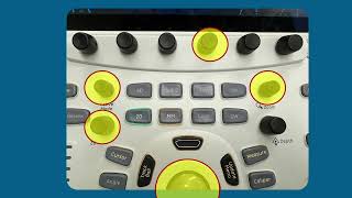 GE VividE95 3D Knobology