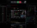 Why Traders Never Leave Their Screens #daytrading #finance