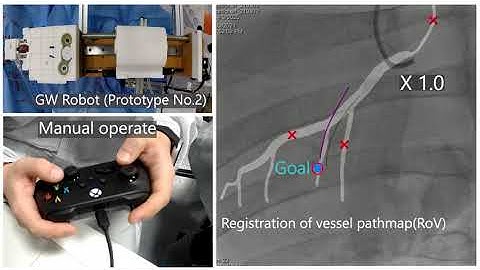 Prototyping a guide-wire robotic device