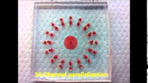 Towards microfluidic-based depletion of stiff and fragile human red cells that accumulate during...
