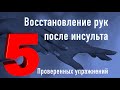 Пять проверенных упражнений для восстановления рук после инсульта.