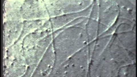 Dissociated Axoplasm - Transport of membranes inside of a squid giant axon