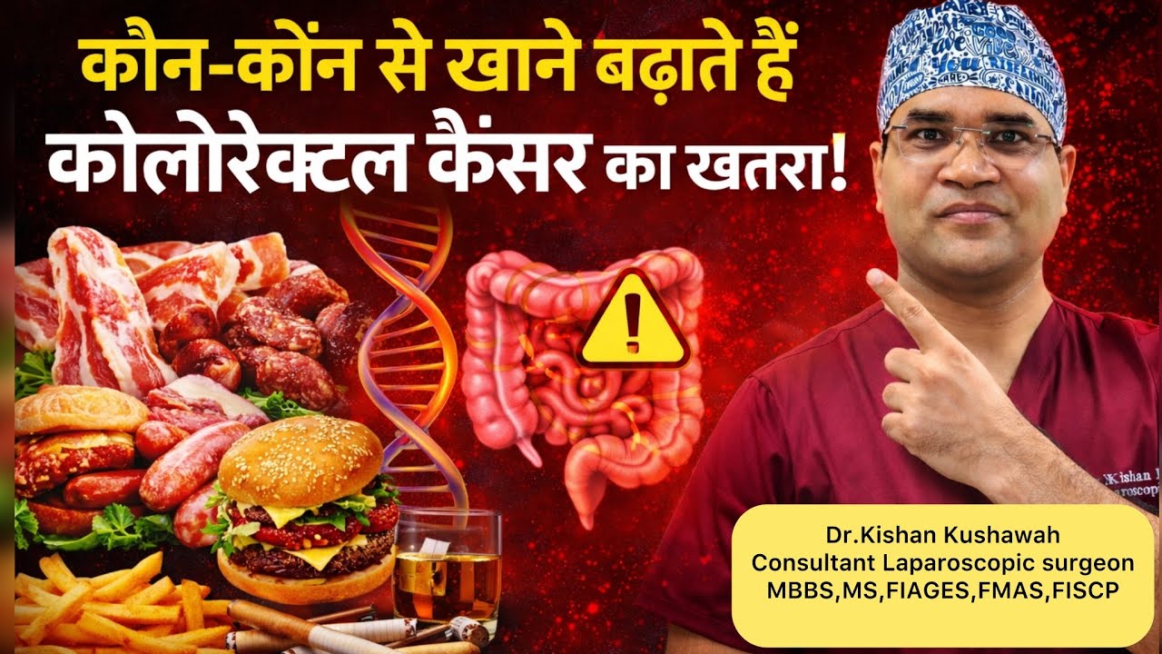 कौन-कौन से खाने से कोलोरेक्टल कैंसर होता है? | Colon Cancer Foods to Avoid | Surgeon Advice