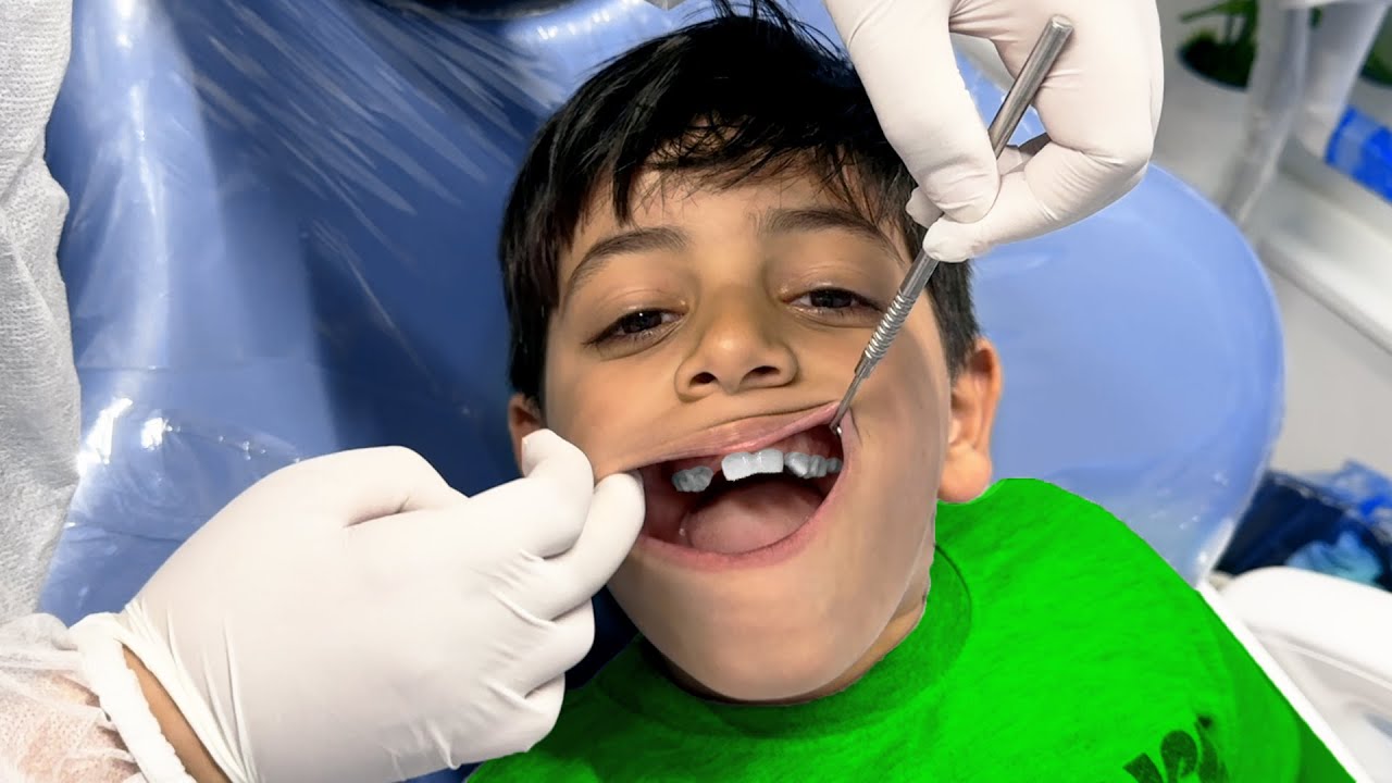 لما ابنك يسمع كلام دكتور الاسنان - فلوق دكتور الاسنان اول مرة