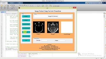 Image Fusion Using Curvelet Transform Matlab Project