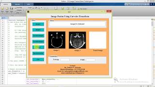 Image Fusion Using Curvelet Transform Matlab Project