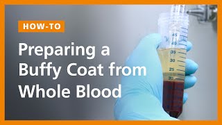 Preparing a Buffy Coat from Whole Blood