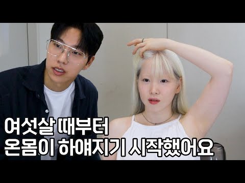 백반증이라고 머리부터 온몸이 하얗게 됐어요. 예전엔 염색하며 다녔는데 지금은 너무 마음에 들어요 !