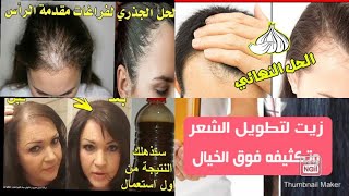 وصفة صاروخية الانبات الشعر في شهر واحد اقسم بالله بتجربة ?‍♀️?‍♂️