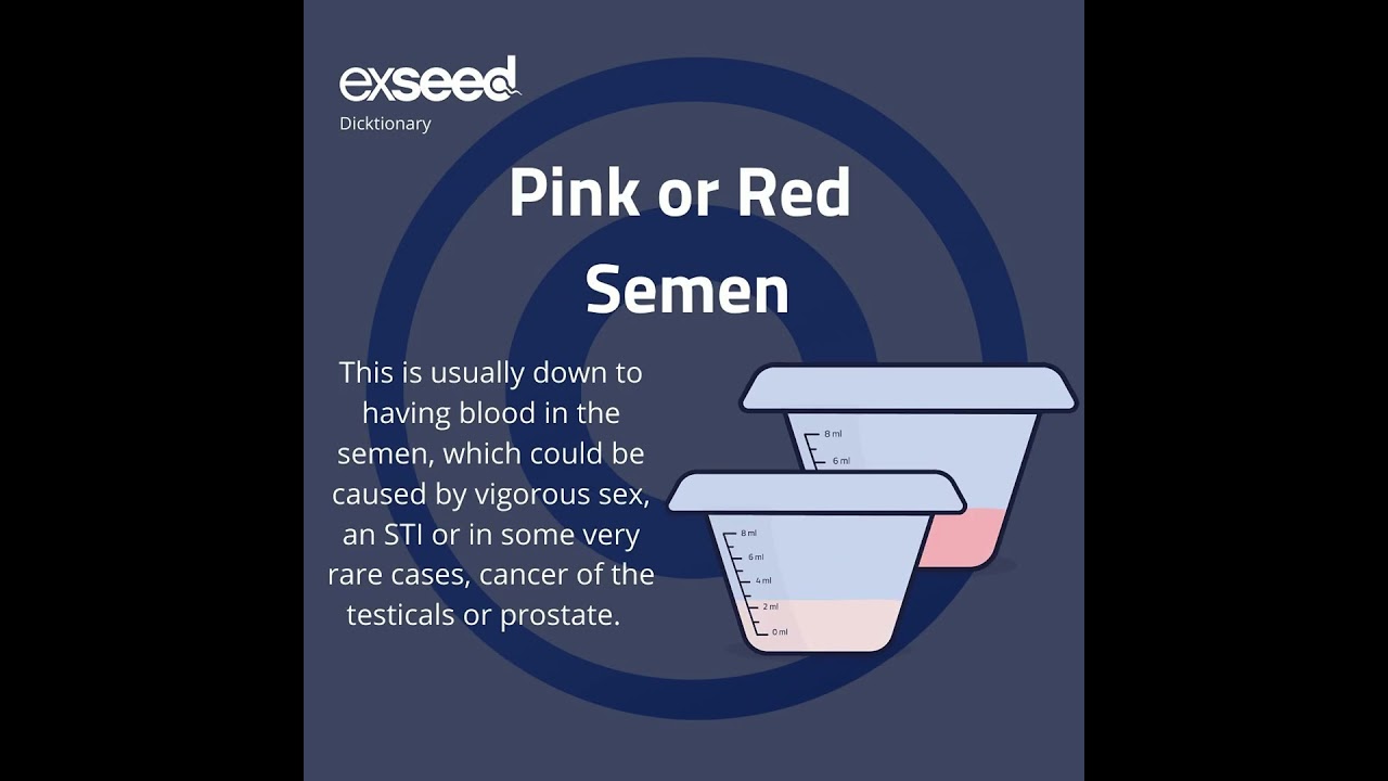 What Your Semen Colour Really Means 👀💦(And When It’s Time to See a Doctor)