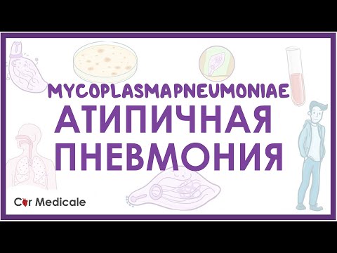 Атипичная пневмония - Микоплазма пневмонии (M.pneumoniae) - клиника, диагностика, лечение