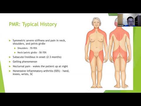 Video: Epidemiologi Genetik: Arteritis Sel Raksasa Dan Polymyalgia Rheumatica