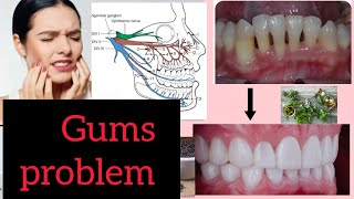 How to keep gum healthy-ayurvedic (part -2) bams ayurvedicmedicine gums oilpulling best