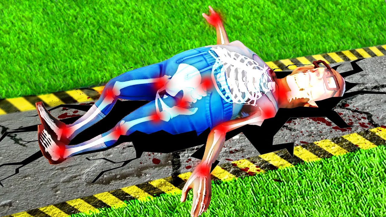 We broke every bone in a human body...