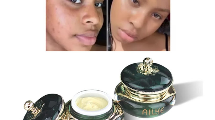 Ailke superior whitening night cream review năm 2024