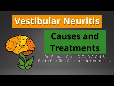 Vestibular neuritis: шалтгаан ба эмчилгээ