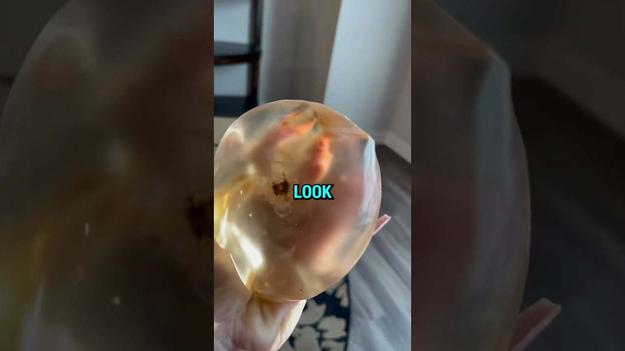 Implants Removed 🤯