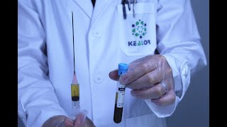 Platelet Rich Plasma PreparationTube /PRP preparation kit