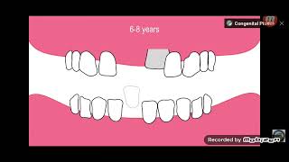 Baby Teeth to Adult Teeth Time Lapse Animation