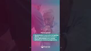 Conheça os 4 estágios da doença de Alzheimer