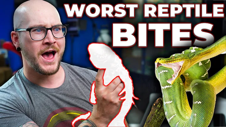 The 5 WORST Reptiles To Get Bit By