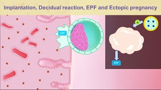 Implantation, Decidual reaction, EPF and Ectopic pregnancy