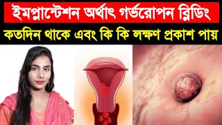 ইমপ্লান্টেশন ব্লিডিং কতদিন থাকে ? ইমপ্লান্টেশন এর লক্ষণ কি