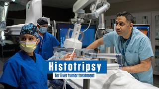 What is Histotripsy for Liver Tumors