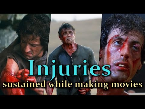 Sylvester Stallone - Injuries sustained while making movies