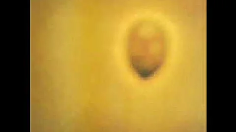 SPINETTA - DURAZNO SANGRANDO (INVISIBLE)