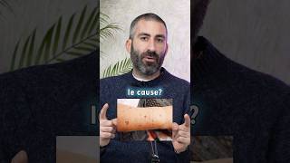 MACCHIE SOLARI: come si curano?
