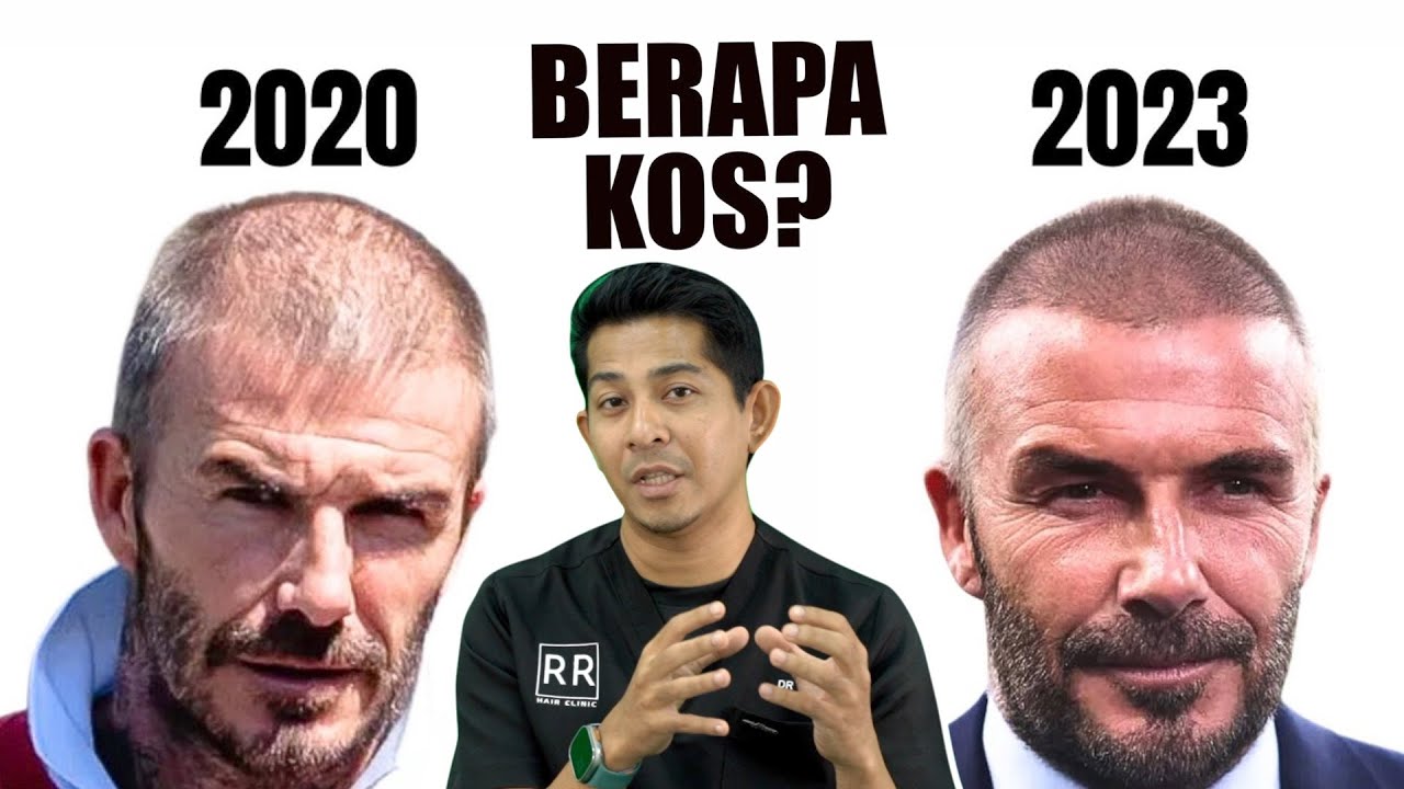 Berapa Kos Tanam Rambut? Turkiye Lagi Murah Ke?
