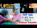 IVF lab में कैसे किया जाता है Embryo transfer | Embryo transfer in IVF lab