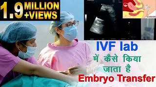 IVF lab में कैसे किया जाता है Embryo transfer | Embryo transfer in IVF lab screenshot 4