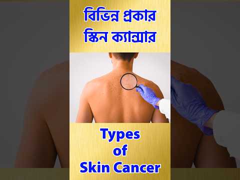বিভিন্ন প্রকার স্কিন ক্যান্সার | Types of Skin Cancer #skincare #skincancerprevention