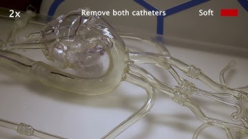 Thermoset Shape Memory Polymer Variable Stiffness 4D Robotic Catheters