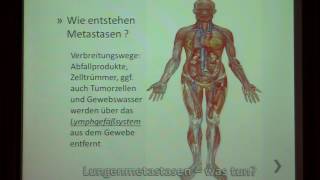 Lungenmetastasen - und nun? | Dr. med. B. Enderes